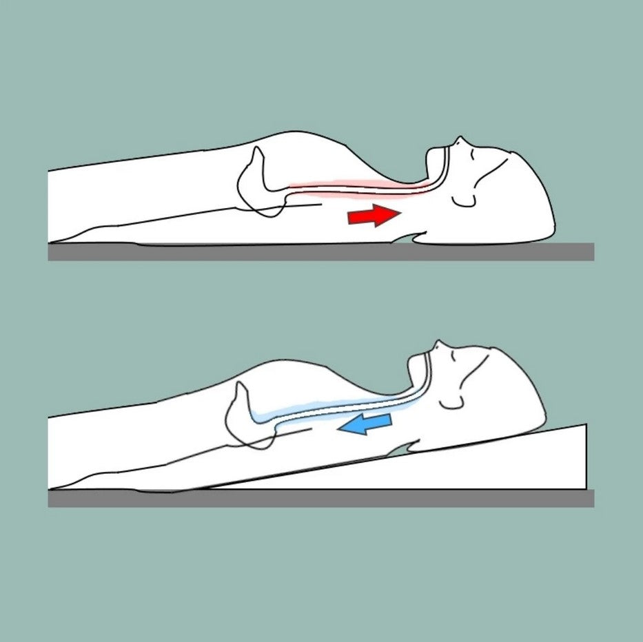 Esophageal Motility Bed Wedge - Acid Reflux